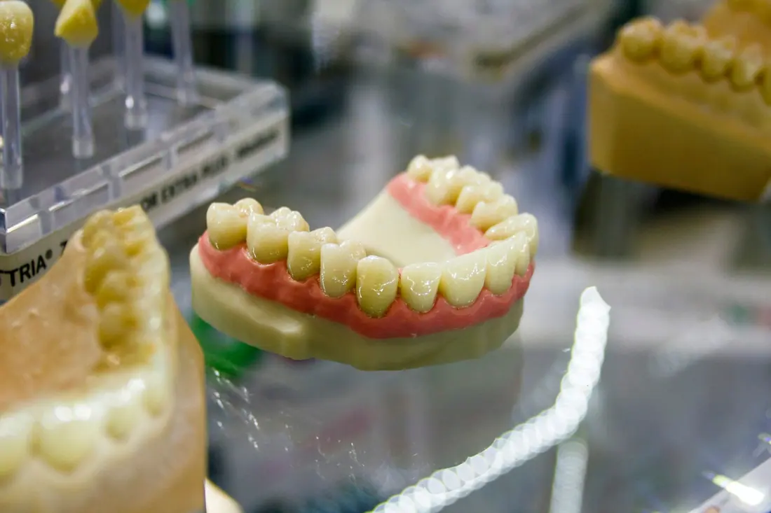 Montaje de dientes de una prótesis removible en el laboratorio