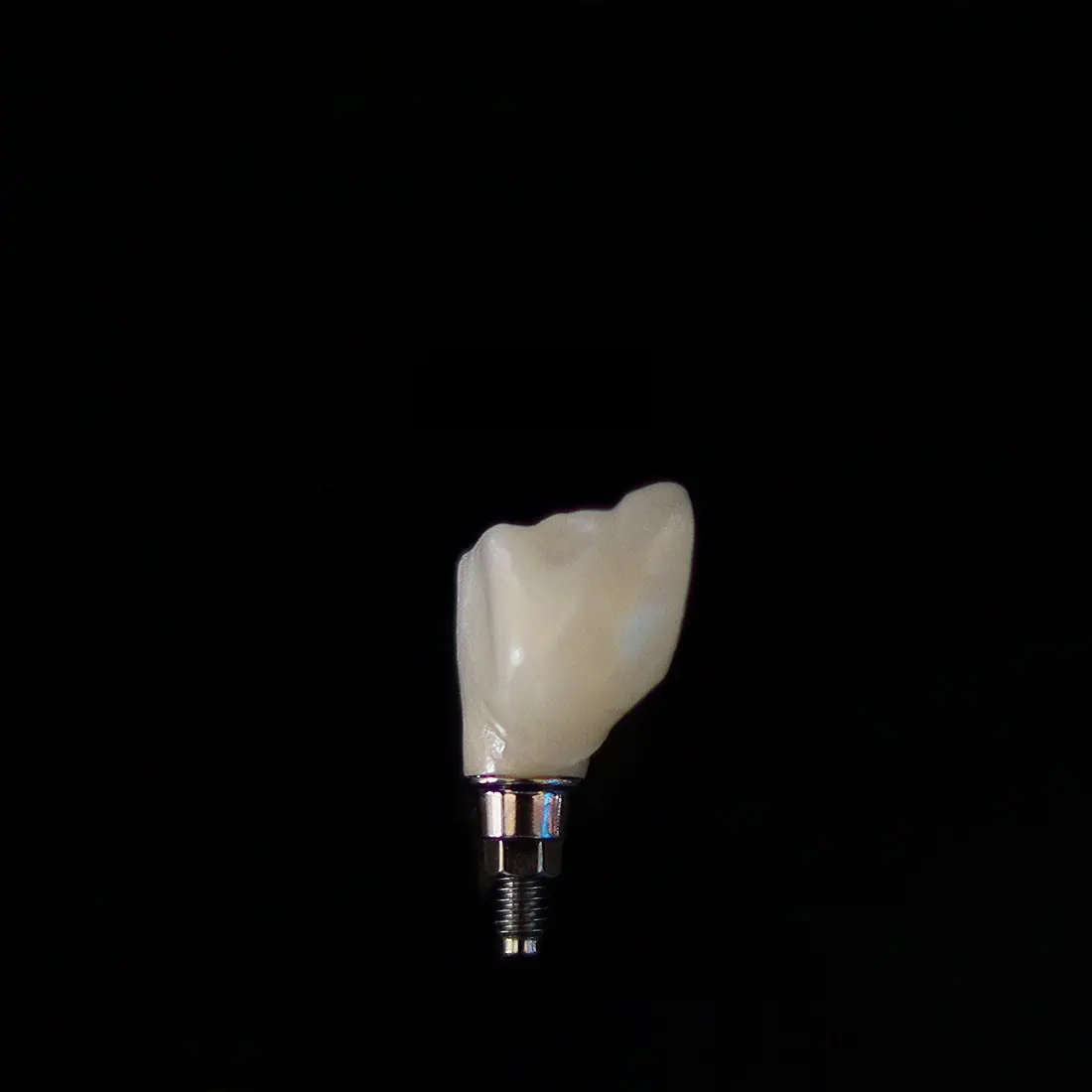 Corona de cerámica sobre un implante dental