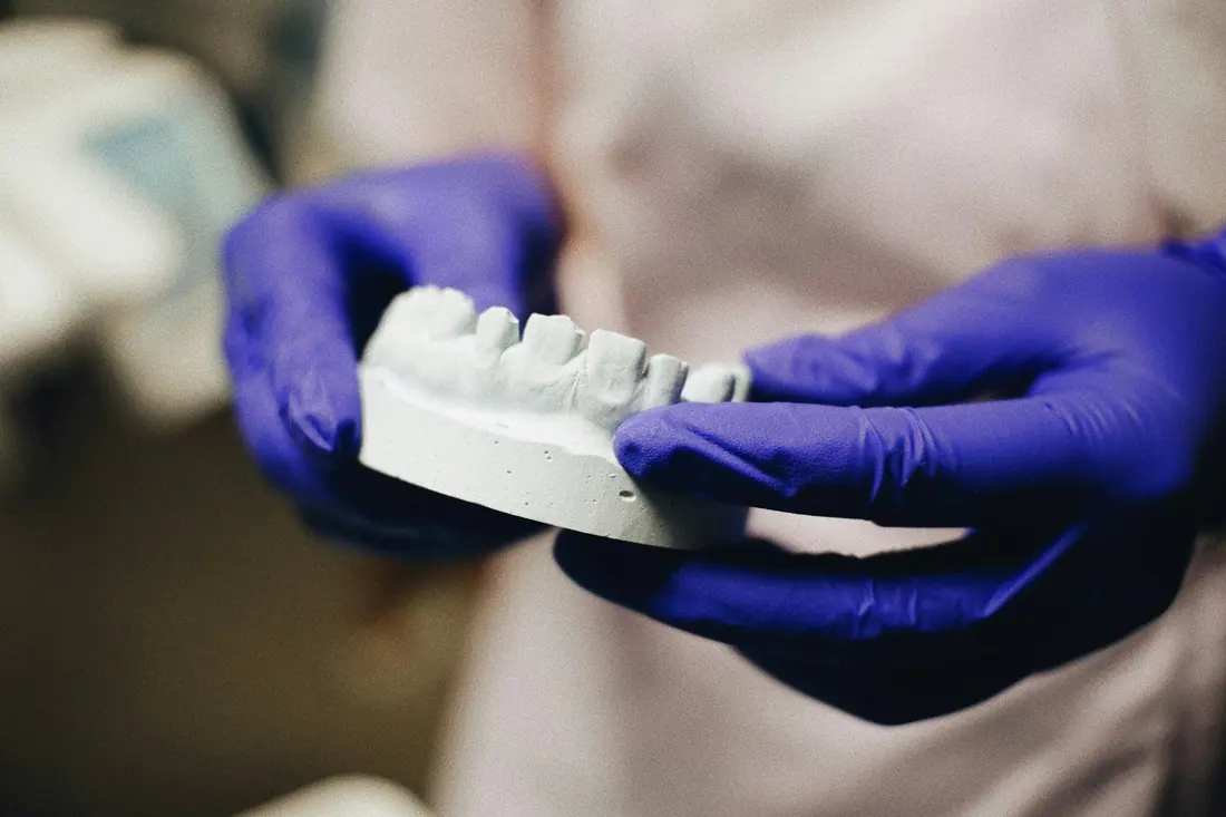 Modelo dental impreso en 3D